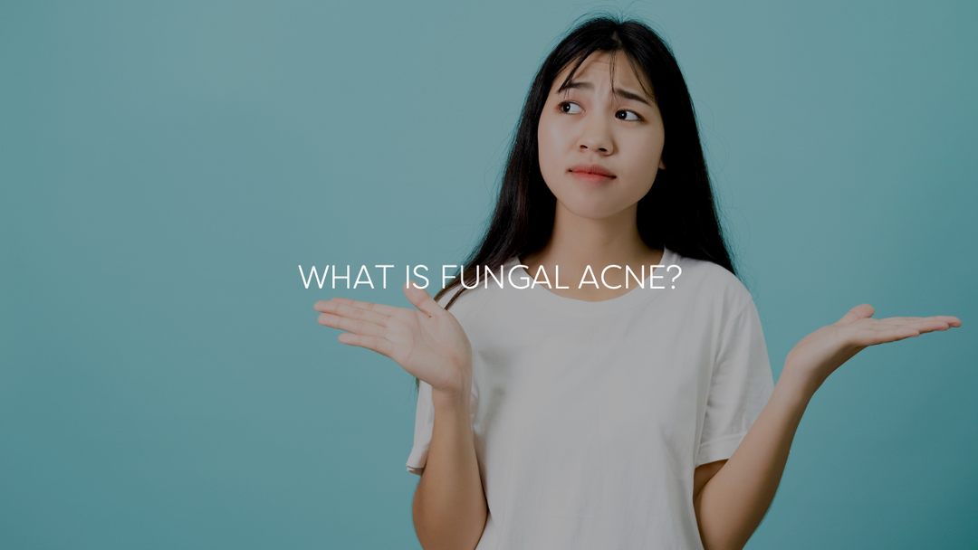 ACNE SERIES 4: What is Fungal Acne?