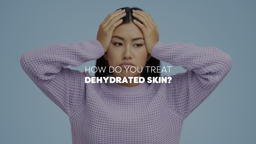 SKINCARE 101: How to deal with dehydrated skin