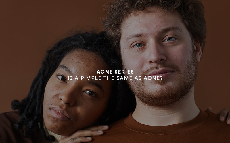 ACNE SERIES 1: What is Acne?