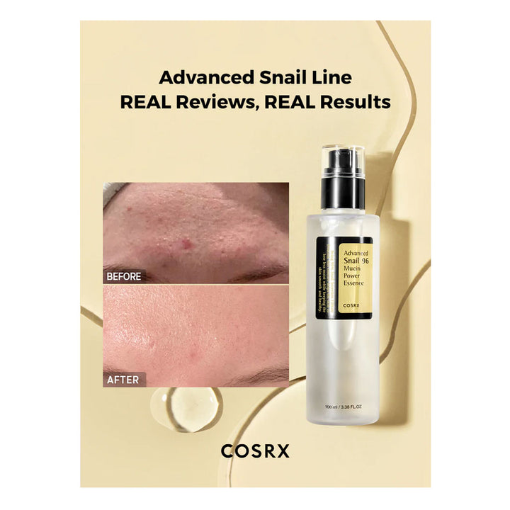 COSRX Advanced Snail 96 Mucin Power Essence - Peaches&Creme Shop Korean Skincare Malta