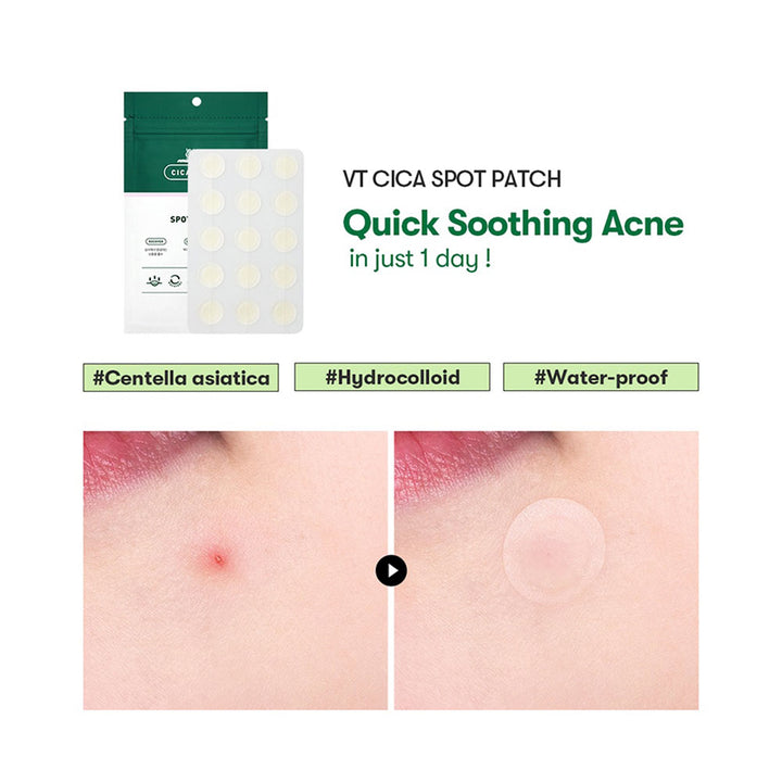 VT Cica Spot Patch - Peaches&Creme Shop Korean Skincare Malta