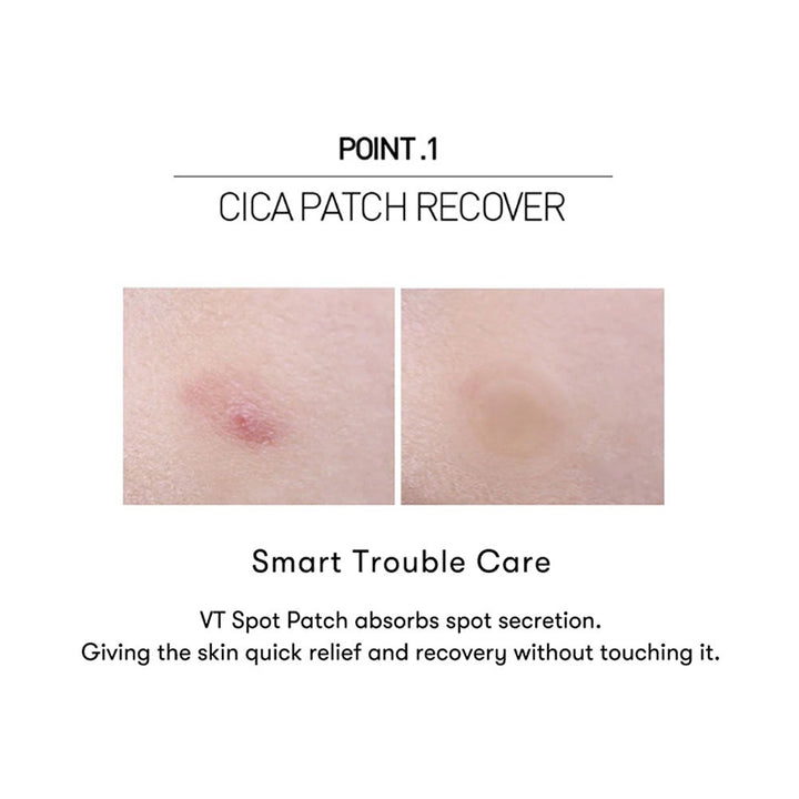 VT Cica Spot Patch - Peaches&Creme Shop Korean Skincare Malta