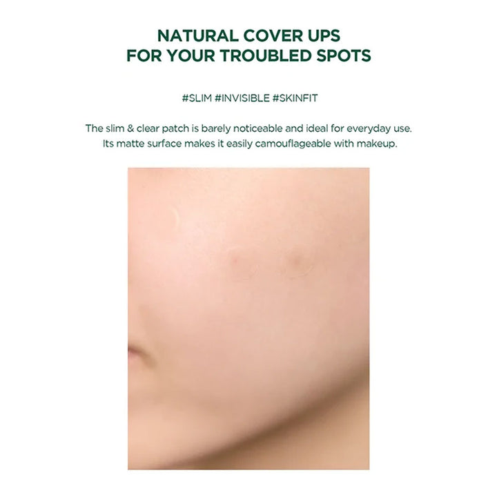 SKIN1004 Tea-Trica Spot Cover Patch - Peaches&Creme Shop Korean Skincare Malta
