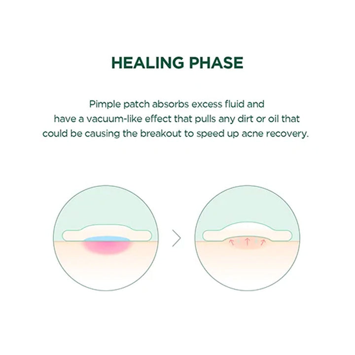 SKIN1004 Tea-Trica Spot Cover Patch - Peaches&Creme Shop Korean Skincare Malta