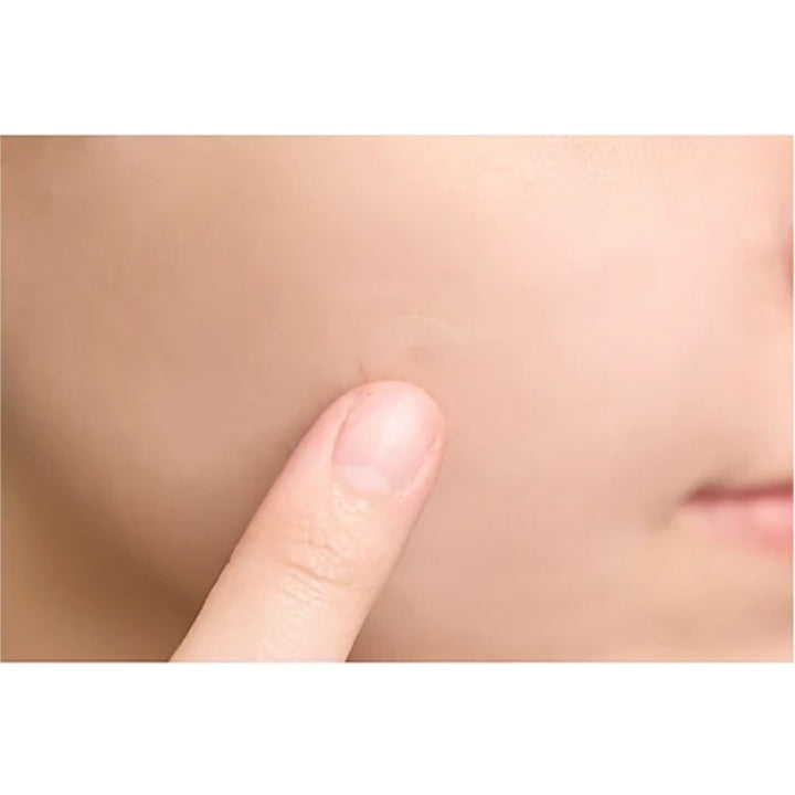SKIN1004 Tea-Trica Spot Cover Patch - Peaches&Creme Shop Korean Skincare Malta
