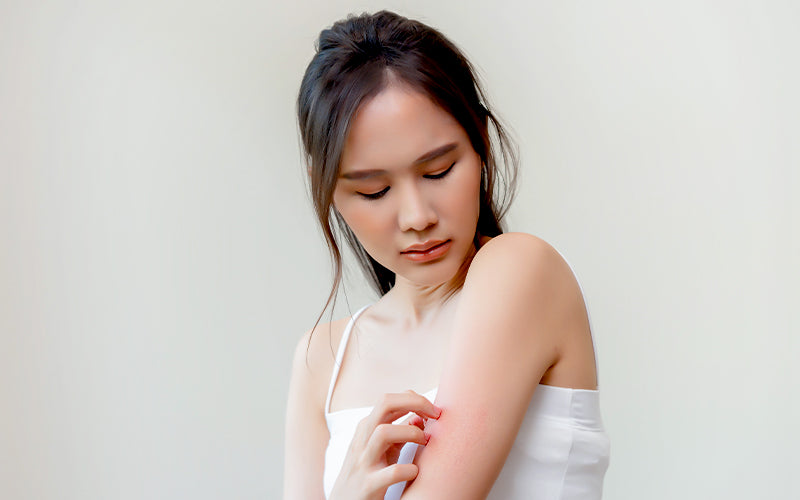 Dermatitis Diaries: Habits That Actually Calm Angry Skin