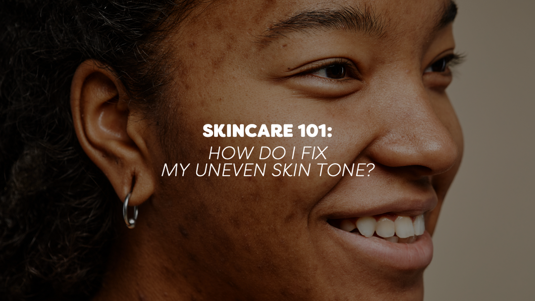 Skincare 101: Hoo do I fix my uneven skin tone?