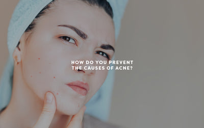 ACNE SERIES 3: What causes acne and how do you prevent it?