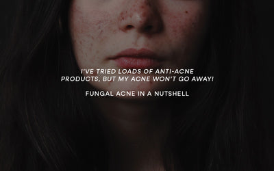 Dealing with Fungal Acne