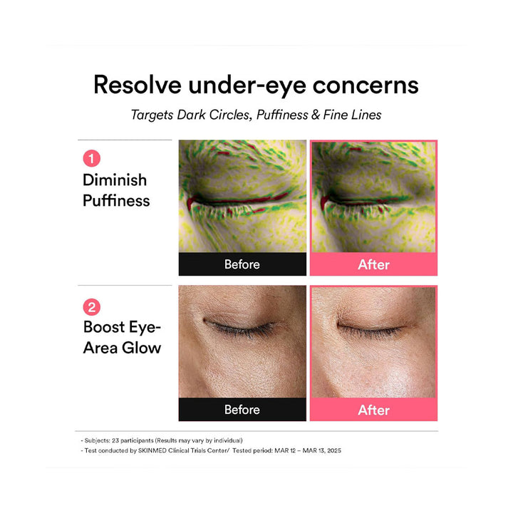 ABIB PDRN Retinal Eye Patch Glow Jelly - Peaches&Creme Shop Korean Skincare Malta