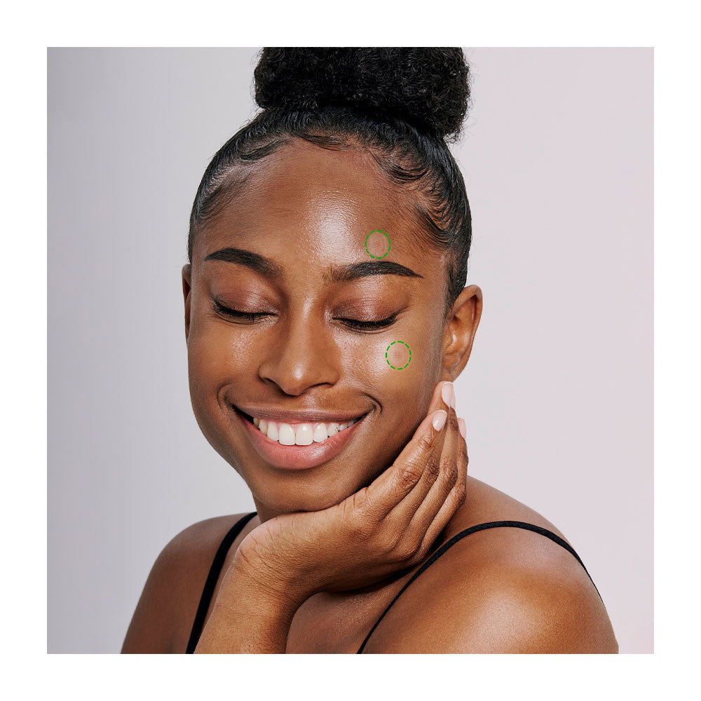 ACROPASS Trouble Care Microcone Patch - Peaches&Creme Shop Korean Skincare Malta