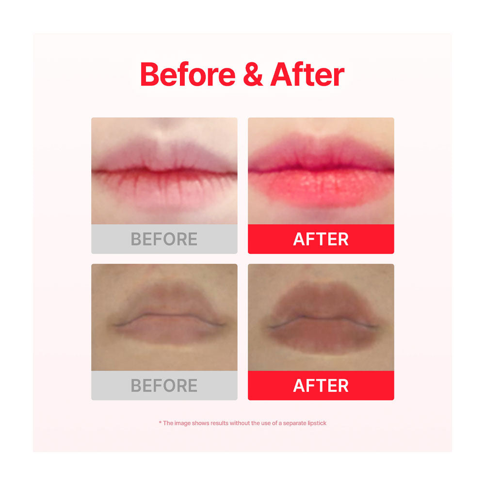 ACROPASS Jolly Filly Lip Plumping Patch - Peaches&amp;Creme Shop Korean Skincare Malta