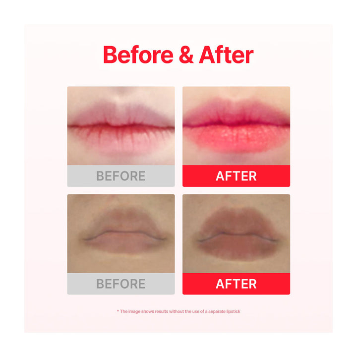 ACROPASS Jolly Filly Lip Plumping Patch - Peaches&amp;Creme Shop Korean Skincare Malta