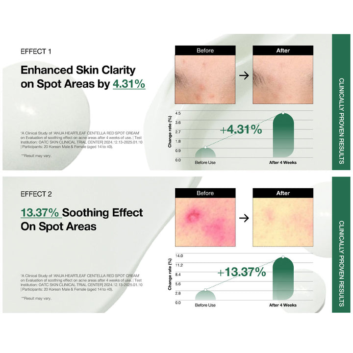 ANUA Heartleaf Centella Red Spot Cream - Peaches&Creme Shop Korean Skincare Malta