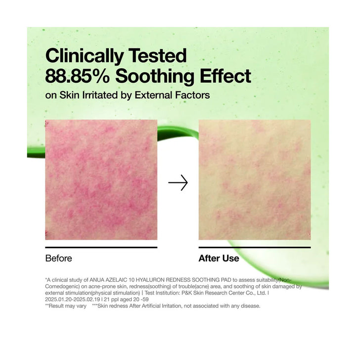 ANUA Azelaic 10 Hyaluron Redness Soothing Pad - Peaches&Creme Shop Korean Skincare Malta