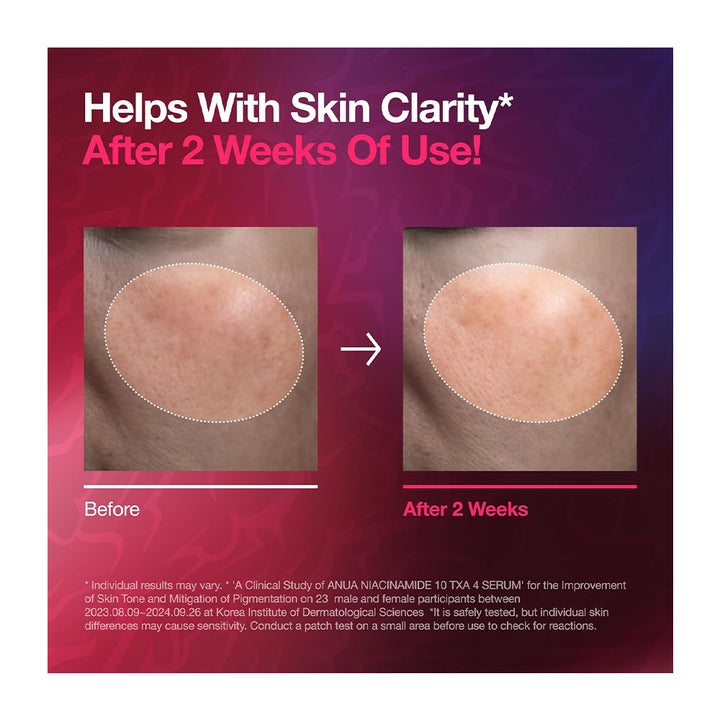 Niacinamide 10% + TXA 4% Serum