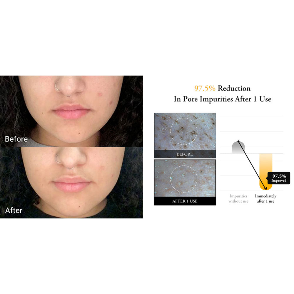 APRILSKIN Real Calendula Peel Off Pack - Peaches&Creme Shop Korean Skincare Malta