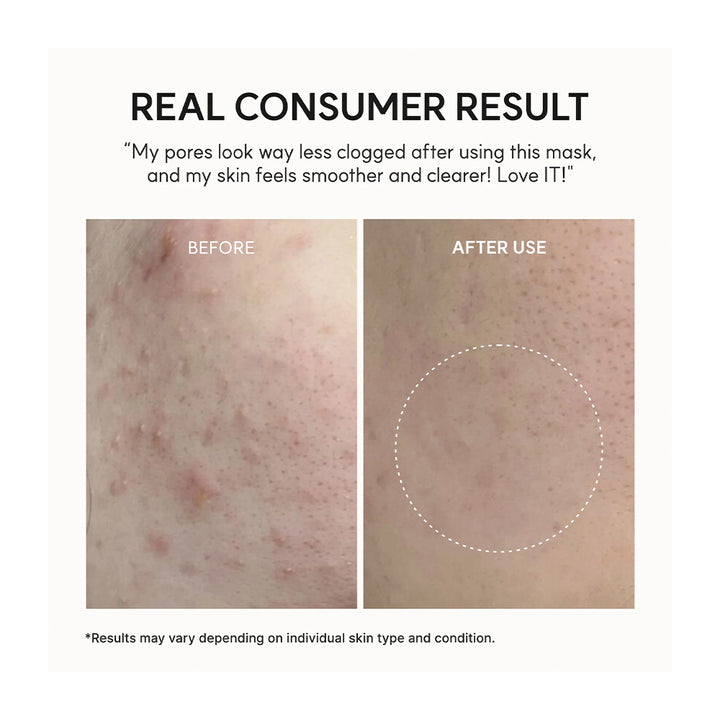 A before-and-after skin comparison graphic with the headline &