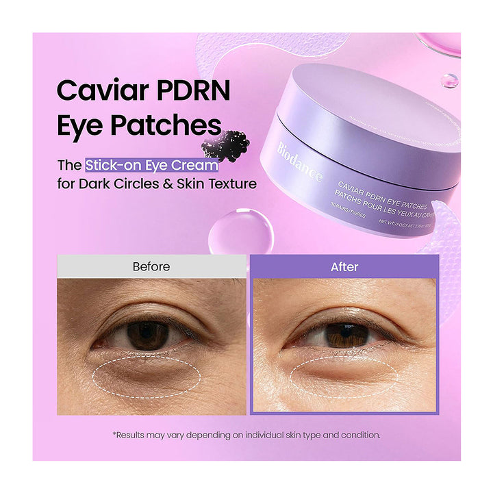 BIODANCE Caviar PDRN Eye Patches - Peaches&Creme Korean Skincare Malta