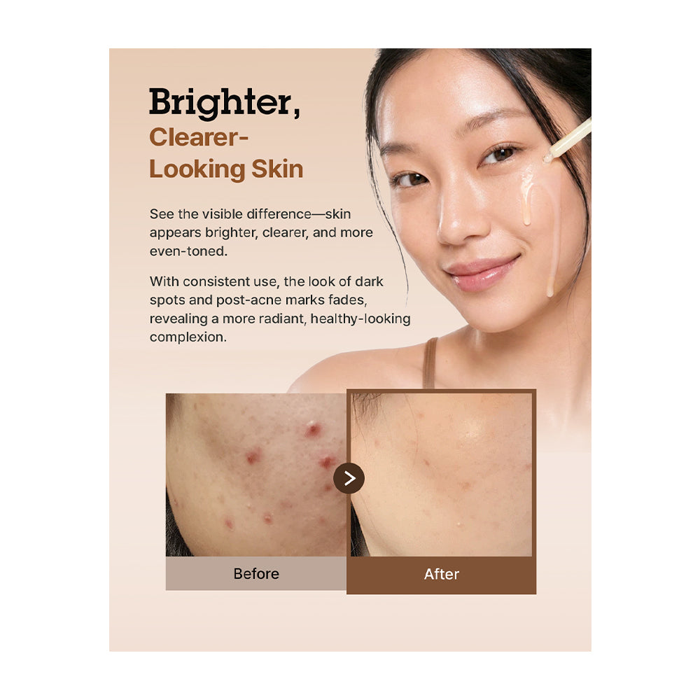 Promotional skincare graphic with text reading 'Brighter, Clearer-Looking Skin' and a close-up of a woman's face showing a glowing complexion. A small inset shows a before-and-after skin comparison, with red blemishes on the 'Before' side and clearer skin on the 'After' side.