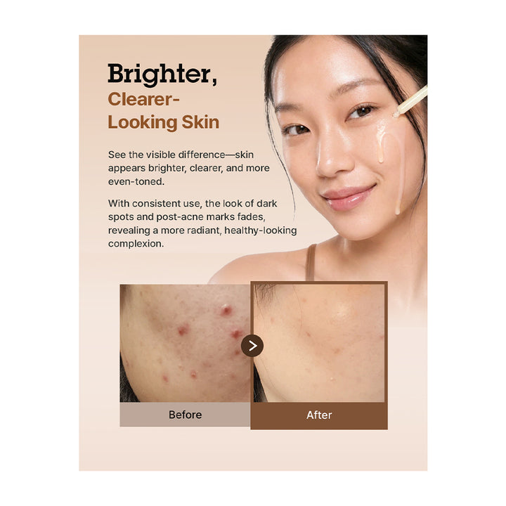 Promotional skincare graphic with text reading &