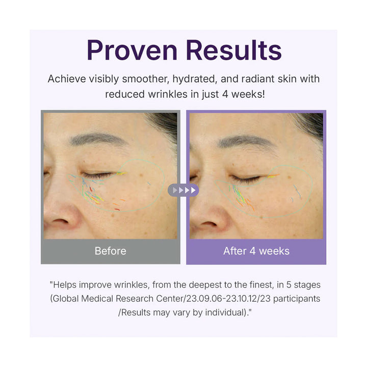 CENTELLIAN24 360 Shot PDRN Active Serum - Peaches&Creme Shop Korean Skincare Malta