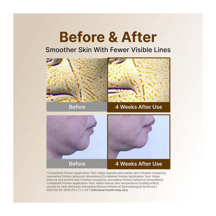 Before and after comparison of smoother skin with fewer visible lines on a beige background.
