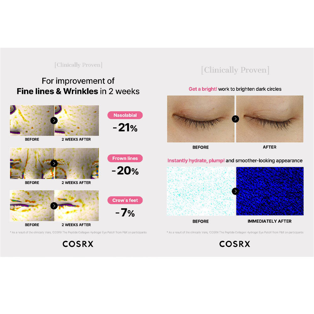 COSRX The Peptide Collagen Hydrogel Eye Patch - Peaches&Creme Shop Korean Skincare Malta