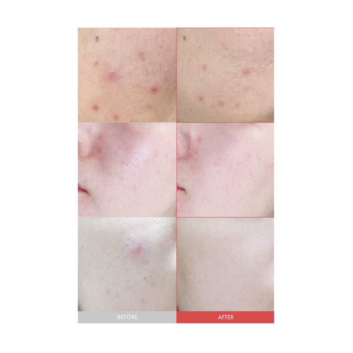 DR.CEURACLE Azelaic10 & Madeca Ampoule - Peaches&Creme Shop Korean Skincare Malta
