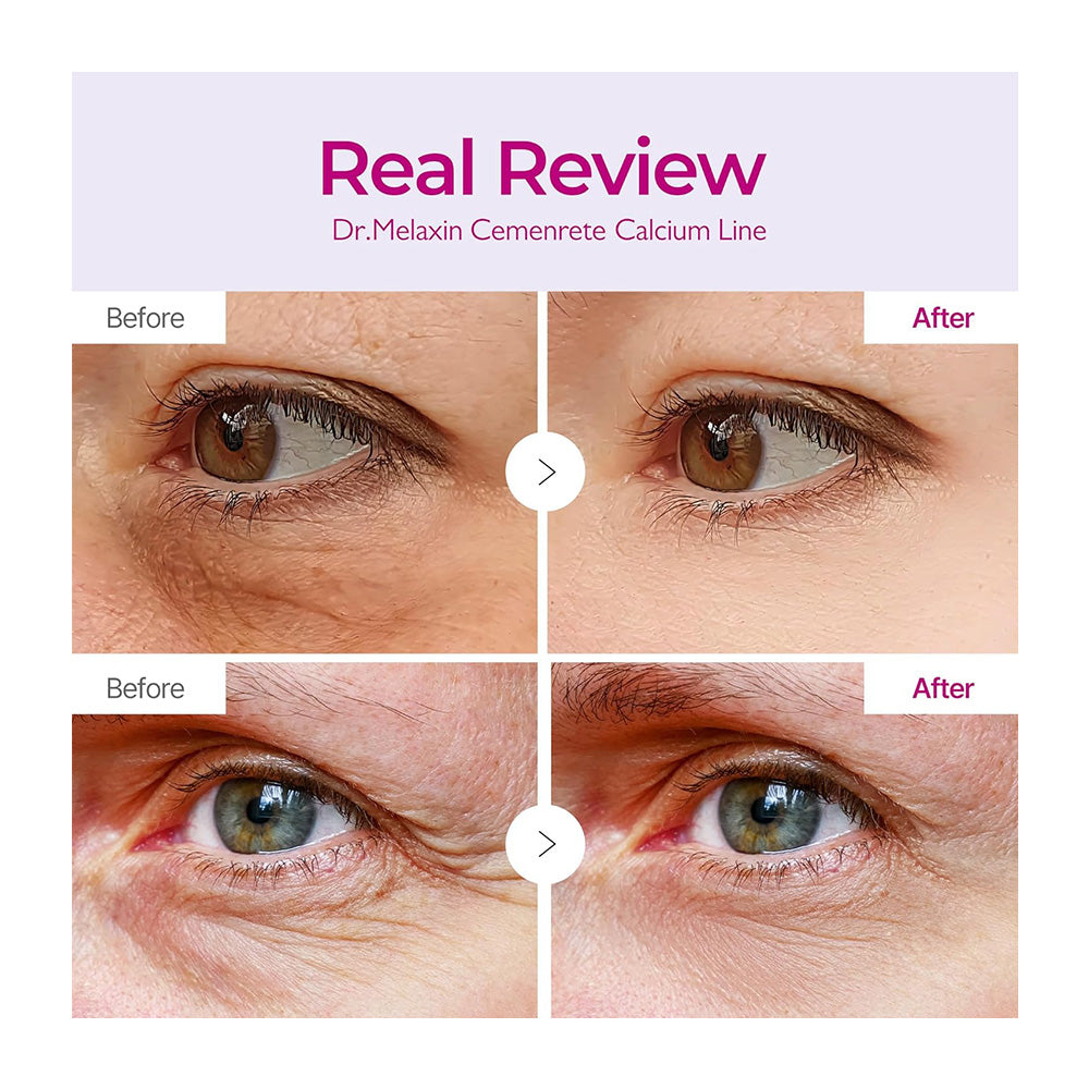 DR.MELAXIN Cemenrete Calcium Volume Eye Patch - Peaches&Creme Shop Korean Skincare Malta