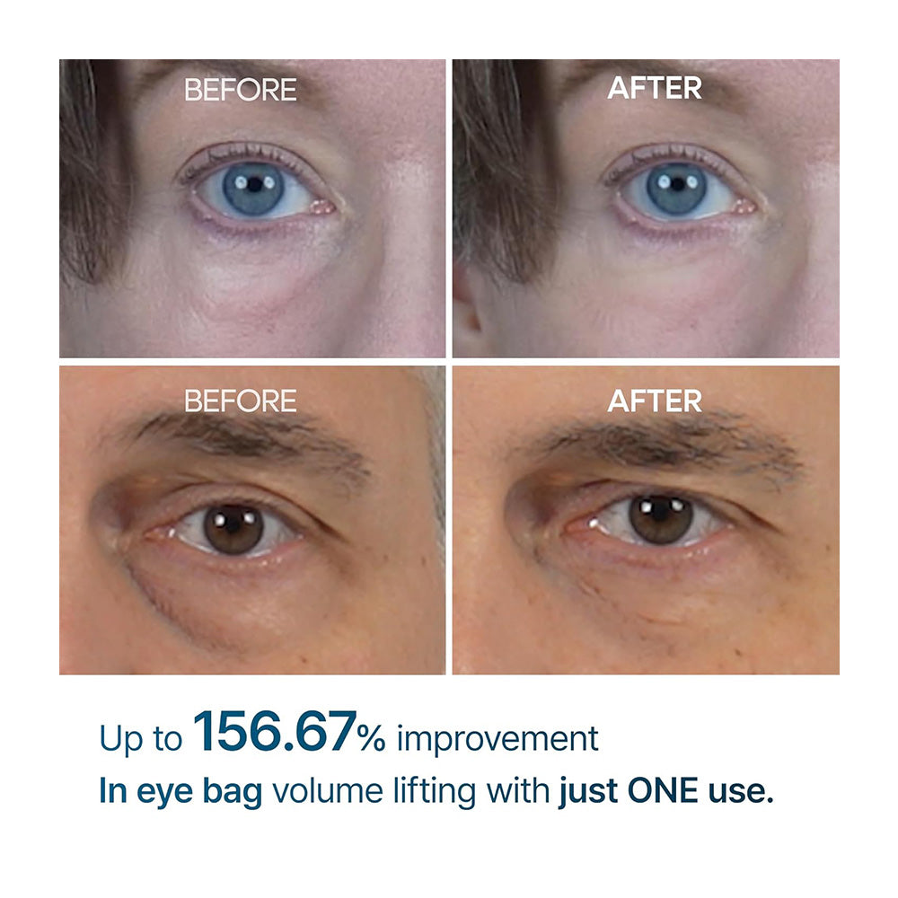 DR.MELAXIN Eyephalt Eyebag Cream - Peaches&Creme Shop Korean Skincare Malta