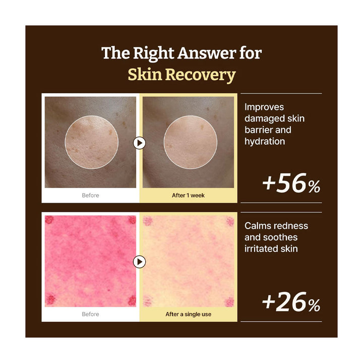 DR. REJU-ALL Advanced PDRN Rejuvenating Cream - Peaches&Creme Shop Korean Skincare Malta