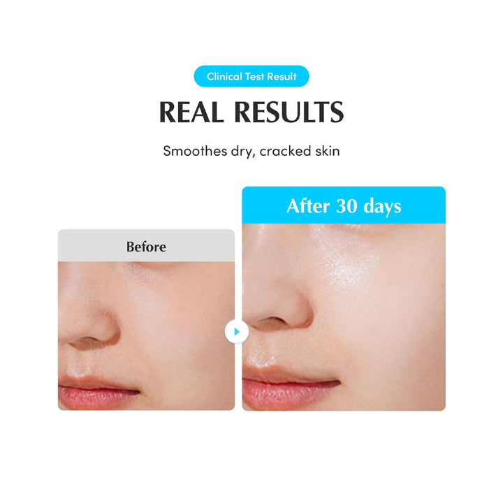 EQQUALBERRY Swimming Pool Ampoule - Peaches&Creme Shop  Korean Skincare Malta