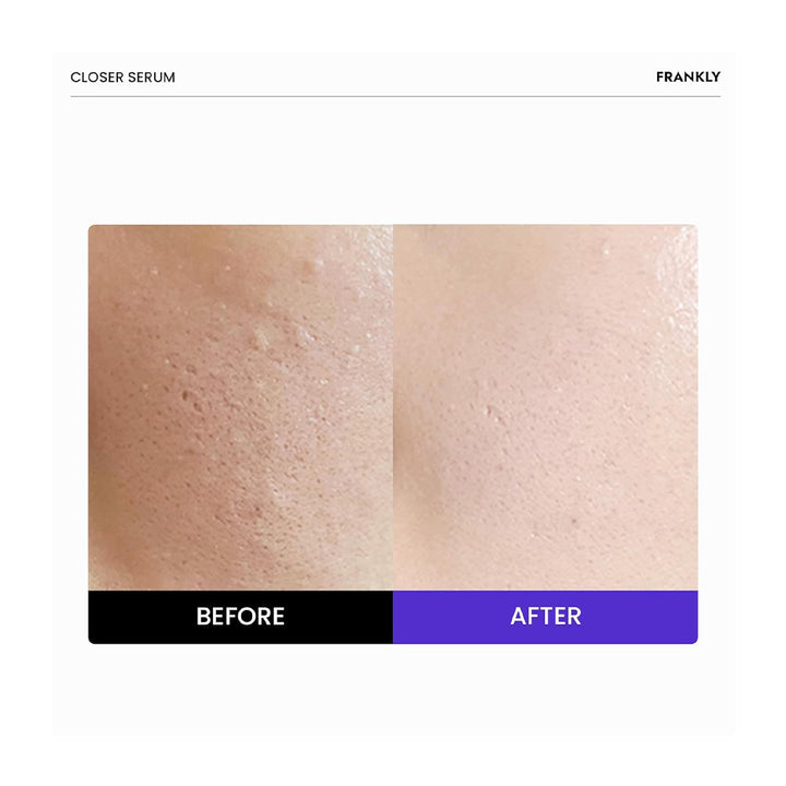 FRANKLY Closer Serum - Peaches&Creme Shop Korean Skincare Malta