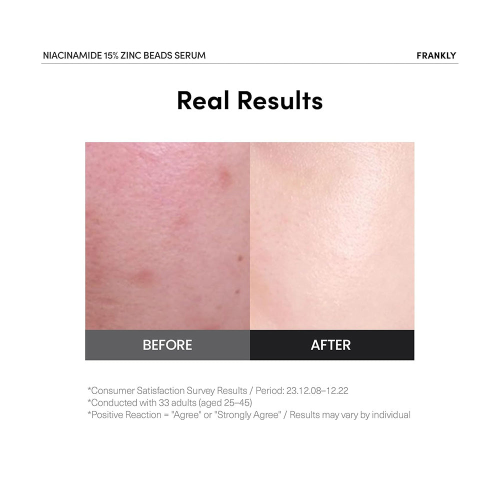 FRANKLY Niacinamide 15% Zinc Beads Serum - Peaches&Creme Shop Korean Skincare Malta