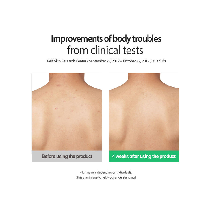 FRUDIA What′s Wrong AC Clear Body Mist - Peaches&Creme Shop Korean Skincare Malta