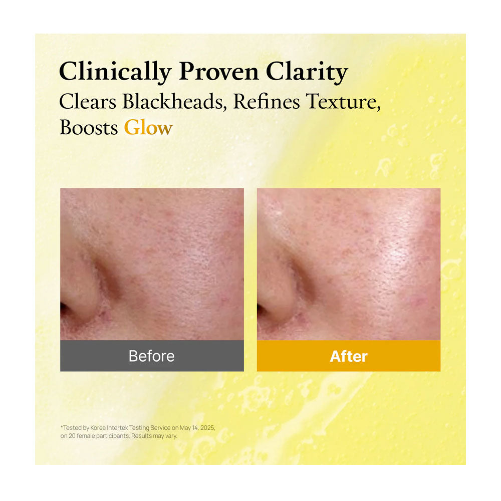 Before and after skin clarity comparison with text &