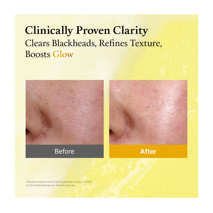 Before and after skin clarity comparison with text &