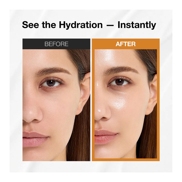 Before and after comparison of a woman&