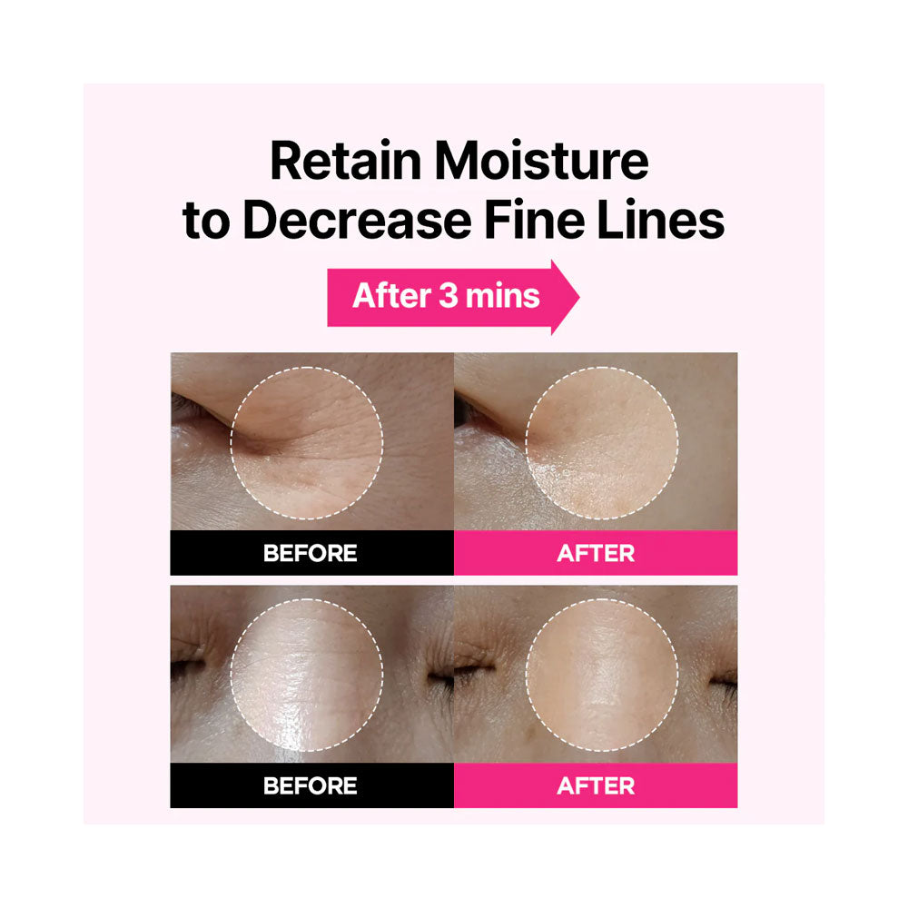 ISOI Blemish Care Eye & Wrinkle Patch - Peaches&Creme Shop Korean Skincare Malta