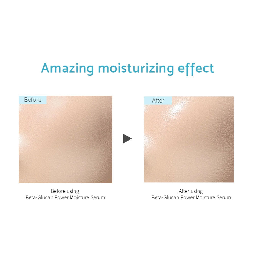 iUNIK Beta-Glucan Power Moisture Serum - Peaches&Creme Shop Korean Skincare Malta