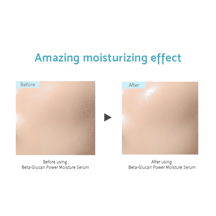 iUNIK Beta-Glucan Power Moisture Serum - Peaches&Creme Shop Korean Skincare Malta