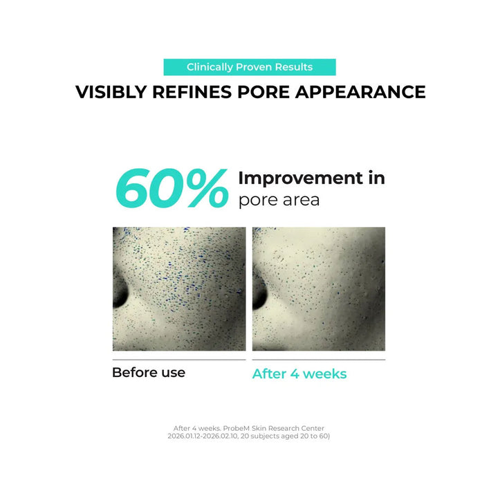 Before and after comparison of pore refinement with text indicating 60% improvement.