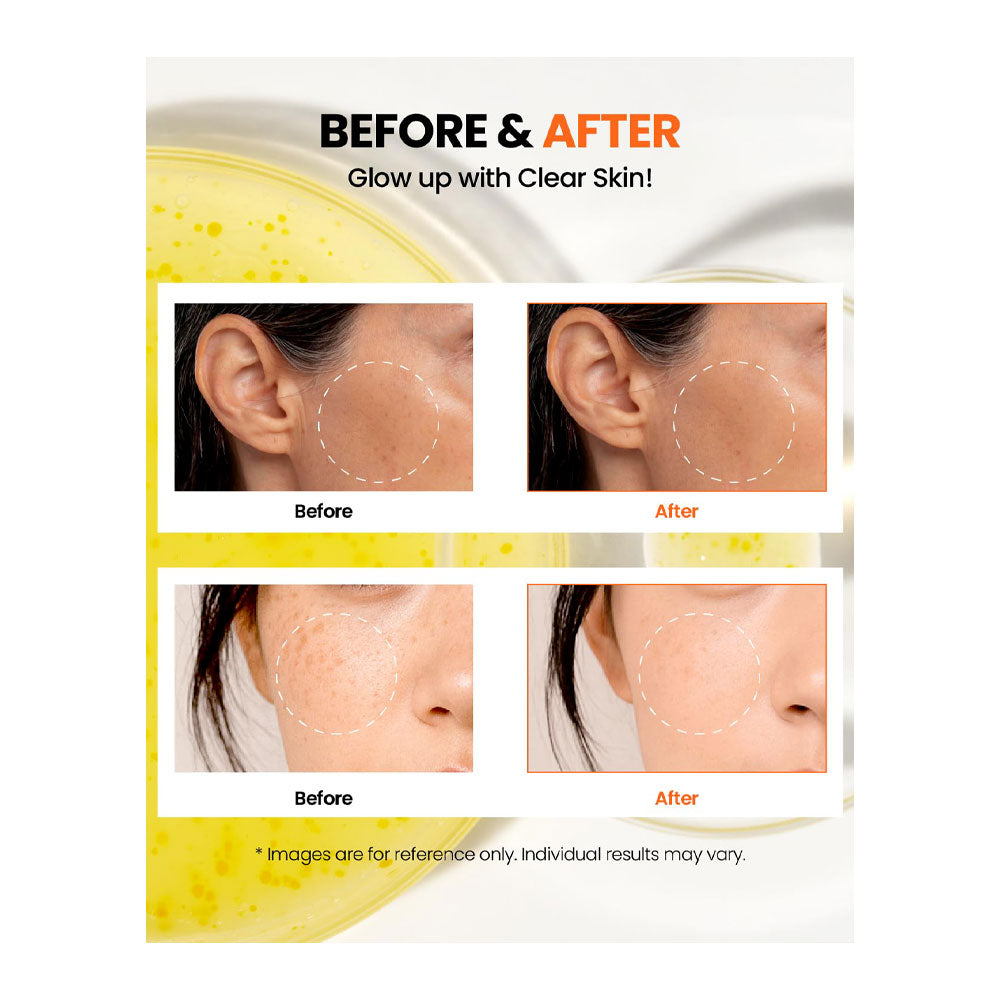 KSECRET Seoul 1988 Glow Serum: Niacinamide 15% + Yuja - Peaches&Creme Shop Korean Skincare Malta