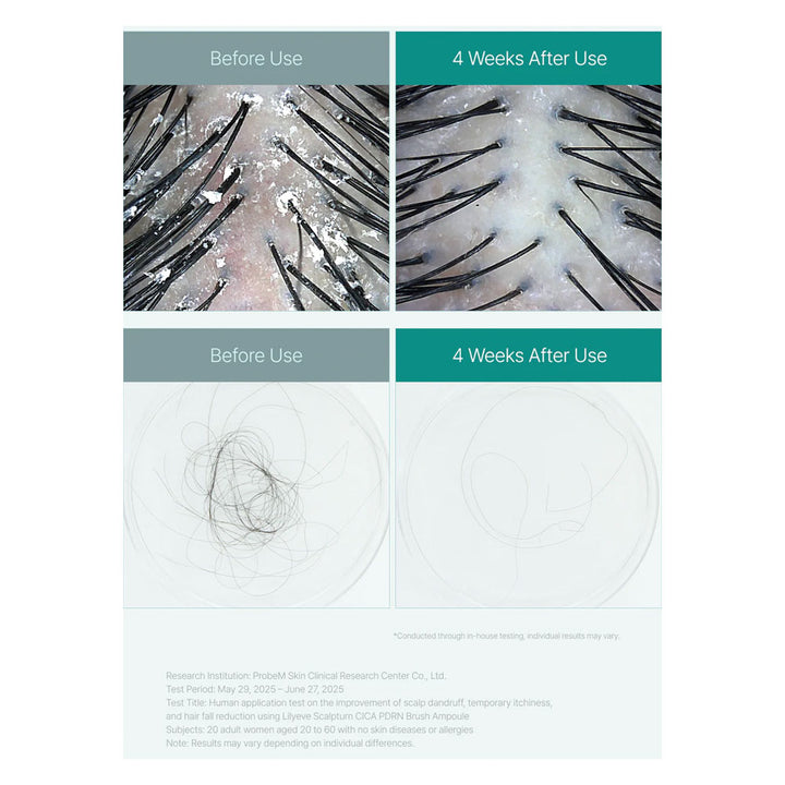 LILYEVE Scalp:Turn Cica PDRN Brush Ampoule - Peaches&Creme Shop Korean Skincare Malta