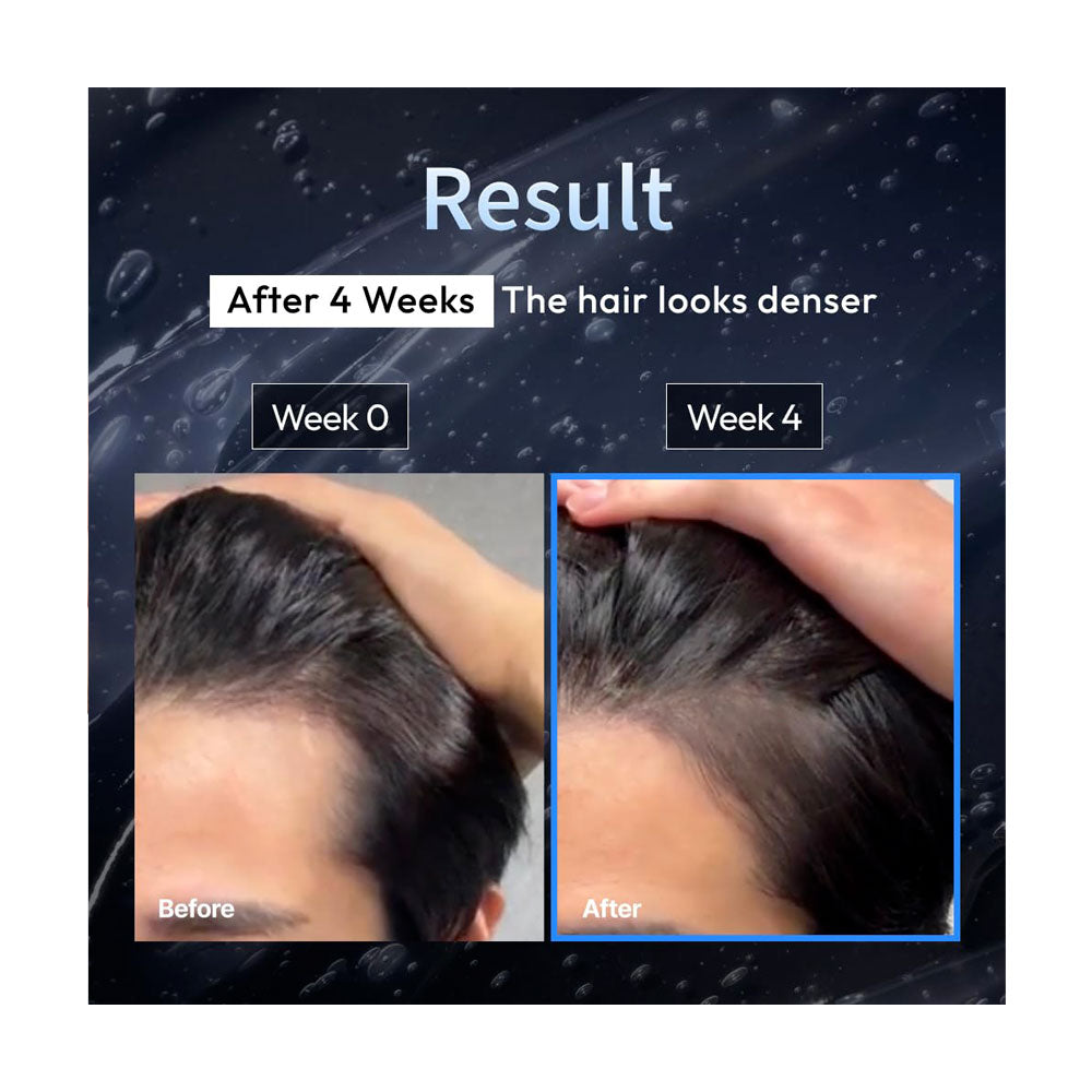 Before and after comparison of hair density after 4 weeks, showing a denser hair appearance.