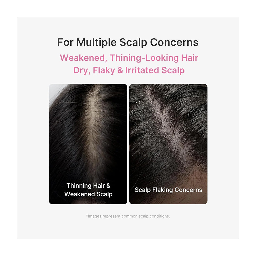 Promotional graphic for scalp concerns, with text reading &