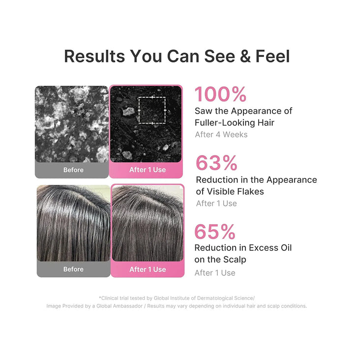 Results graphic for a hair care product showing before-and-after scalp close-ups and hair texture images, with text stating &