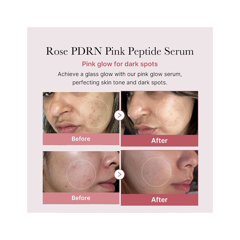 MEDICUBE PDRN Pink Peptide Glow Serum - Peaches&Creme Shop Korean Skincare Malta