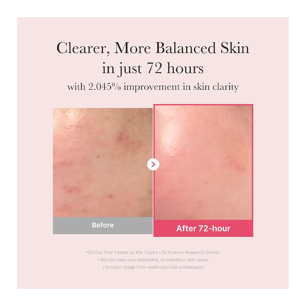 ANUA TXA Niacinamide 15 Serum - Peaches&Creme Shop Korean Skincare Malta
